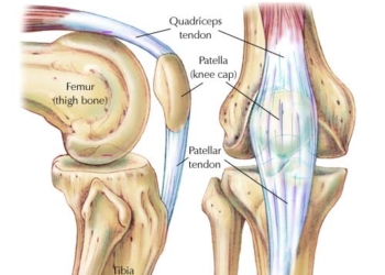 Nyeri di Lutut Sehari Sampai Dua Kali
