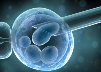 Pusat Radiologi dan Steam Cell di Surabaya