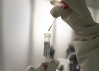 Harap-Harap Cemas, Hasil Swab Test Santri Temboro Asal Ngawi Belum Juga Keluar